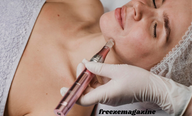 cosmetic mole removal in Cambridge