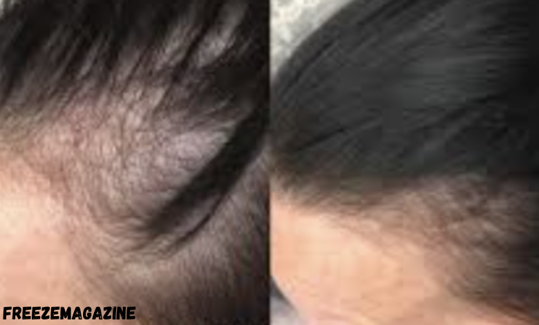 help with Hair Loss