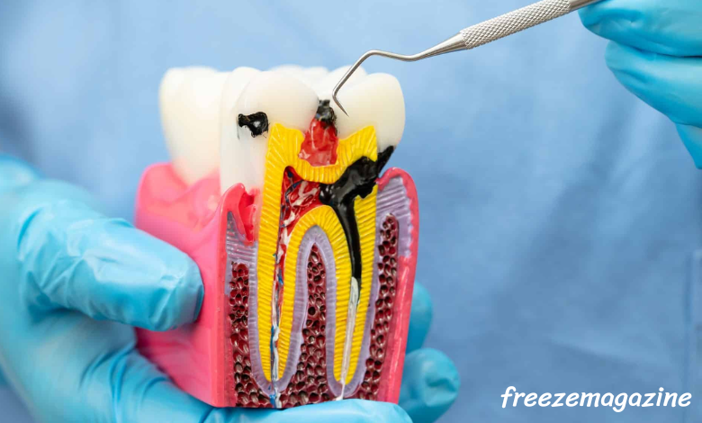 Endodontics