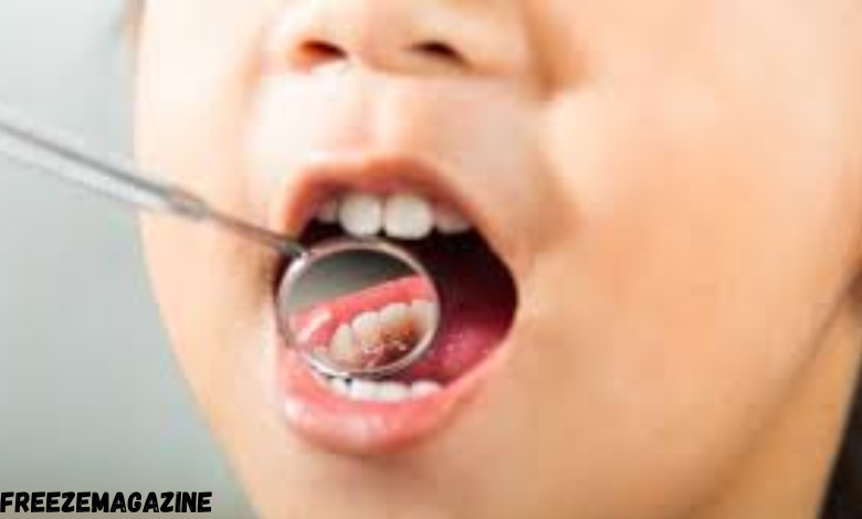dental hygiene services